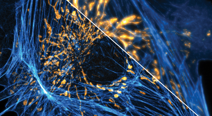 geavanceerde microscopie