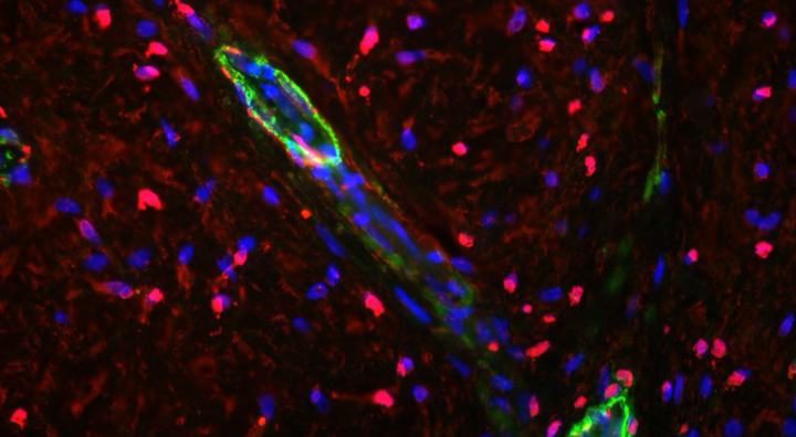 Angiogenesis